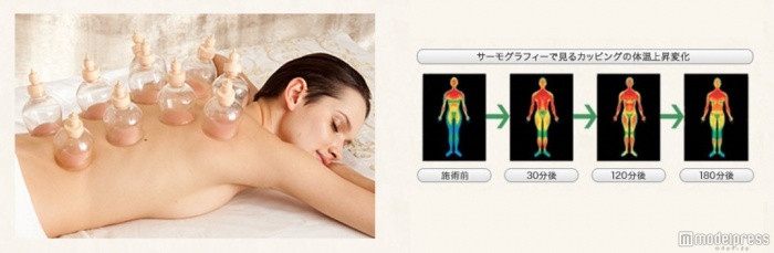 カッピングでカラダの巡りをケア