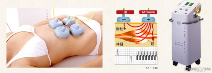 骨盤周りの筋肉を鍛える「Mキューブウェーブ」