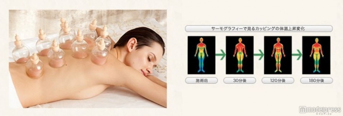 体の巡りをケアするカッピング