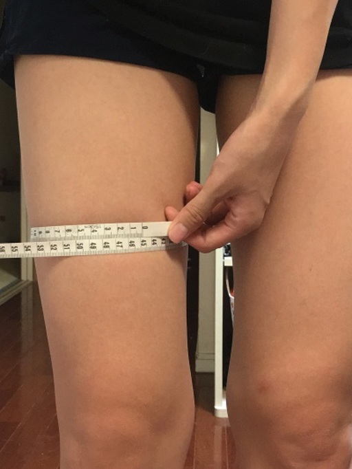 太もも経過写真４