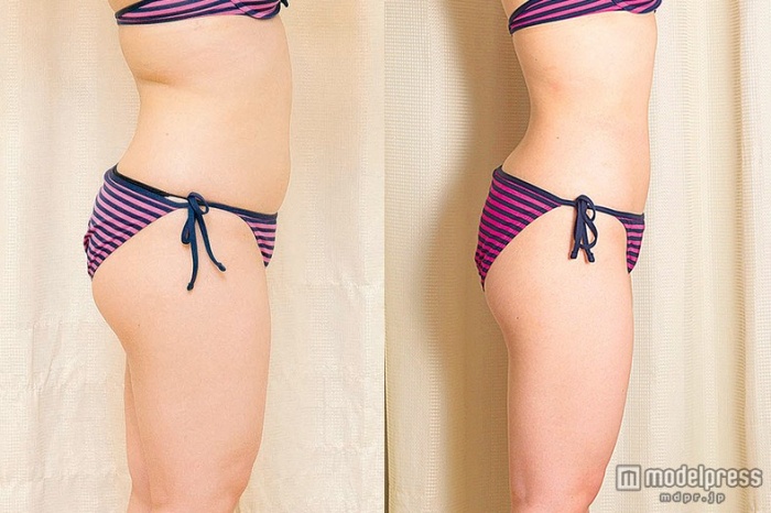 最先端技術で頑固な脂肪とバイバイ！