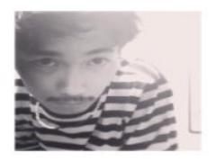 私だって出したいもん。慢性化したおでこニキビにグッバイ計画、ついにスタート