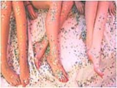 〔原因別〕美脚の作りかた♡あなたが脚太なのは、むくみ？筋肉？それとも脂肪？