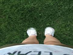 本当の美脚になりたいあなたに。「かさぶた」の3つのイライラ解消法♭