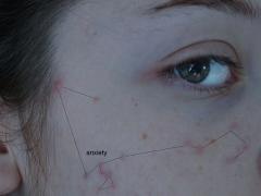 2ヶ月でニキビ0！つるぴか肌を手に入れるMYシンプルスキンケア