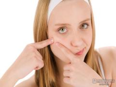 大人ニキビと戦う4S？つるつる美肌を手にいれる法則