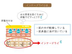 実は肌の内部はカッサカサ！夏はインナードライ肌に気をつけて。