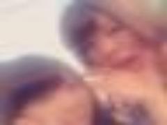 スカート履けないピンチ！〈時間経過別〉青あざを早く治す方法