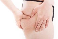 【緊急ダイエット】太ももセルライトとおさらばしたい！1日3分のストレッチでスッキリさせ