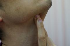 二重あごの原因は&ldquo;たるみ&rdquo;じゃなくて&ldquo;コリ&rdquo;だった！？ あごの筋肉のほぐし