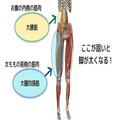 寝たままできる！太もも痩せには○○を伸ばすストレッチが効果的 -